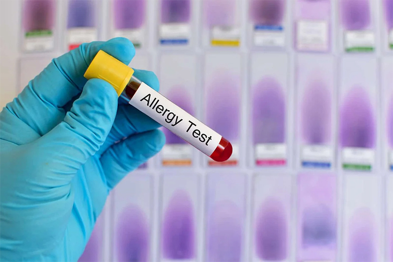 blood allergy test