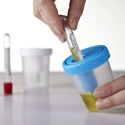 Urine-Specimen-Kit-w-Needle-and-Tube