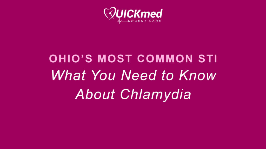 Ohios most common STI. What you need to know about chlamydia